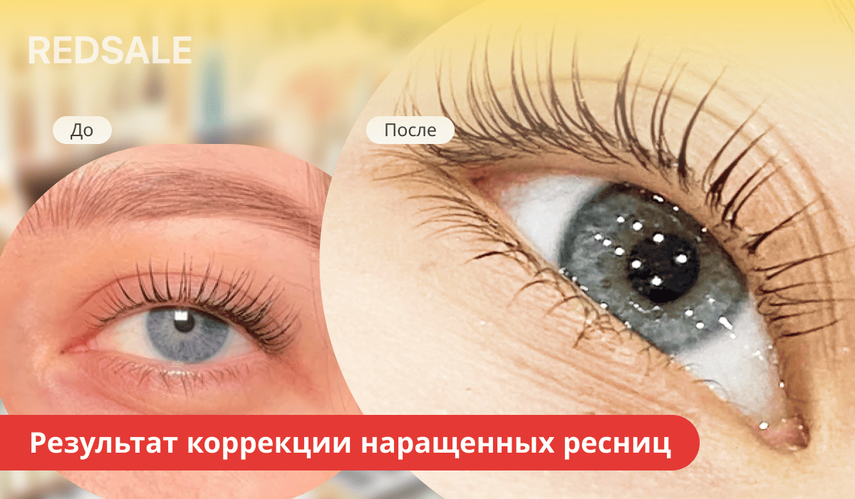 Коррекция наращенных ресниц: сравнение состояния до и после процедуры