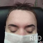 Коррекция бровей — это процесс придания формы, который включает удаление лишних волосков пинцетом или нитью. Это делает взгляд более открытым и ухоженным.
Использованные материалы:
нить, пинцет, ватные диски, скраб, обезжириватель и хлоргексидин.