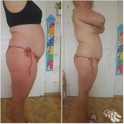 Антицеллюлитный массаж с липолитиком 