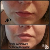 Перманентный макияж губ