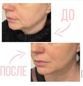 Улучшение контуров лица