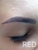 Коррекция бровей нитью (тридинг) - восточная техника моделирования бровей с помощью хлопковой нити, перекрученной в петлю-ловушку. Метод позволяет удалять волоски (мелкий пушок) с корнем, обеспечивая высокую точность, чистоту контура и быстроту процедуры.