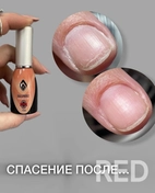 Лечение ногтей системой Magnetic-это профессиональная методика восстановления, укрепления и защиты натуральных ногтей, основанная на использовании герметикa Seal&Protect. Препарат проникает в структуру ногтя, склеивая чешуйки, создавая прочный полим-й слой.