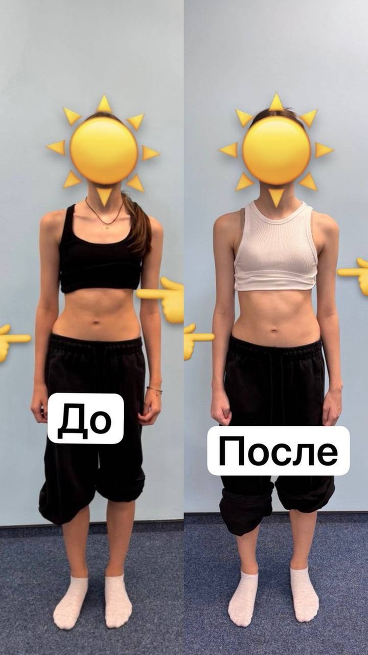 Тело постепенно возвращается во фронтальный баланс: треугольники талии становятся более симметричными.