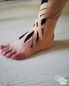 Стабилизация, дренаж кинезиотейп