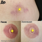 Татуаж сосков