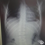 До начала процедуры