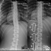Год работы, массаж, лфк