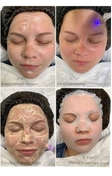 BB Glow Treatment 
