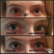Перманентный макияж, межресничка