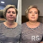 Возрастной макияж выполнен с применением корректоров, тональных средств и хайлайтеров для осветления и подчеркивания черт лица.
Использованы мягкие тени и контурные карандаши для создания естественного и свежего образа.
